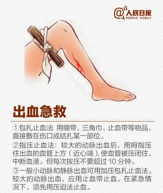 FPC厂家
